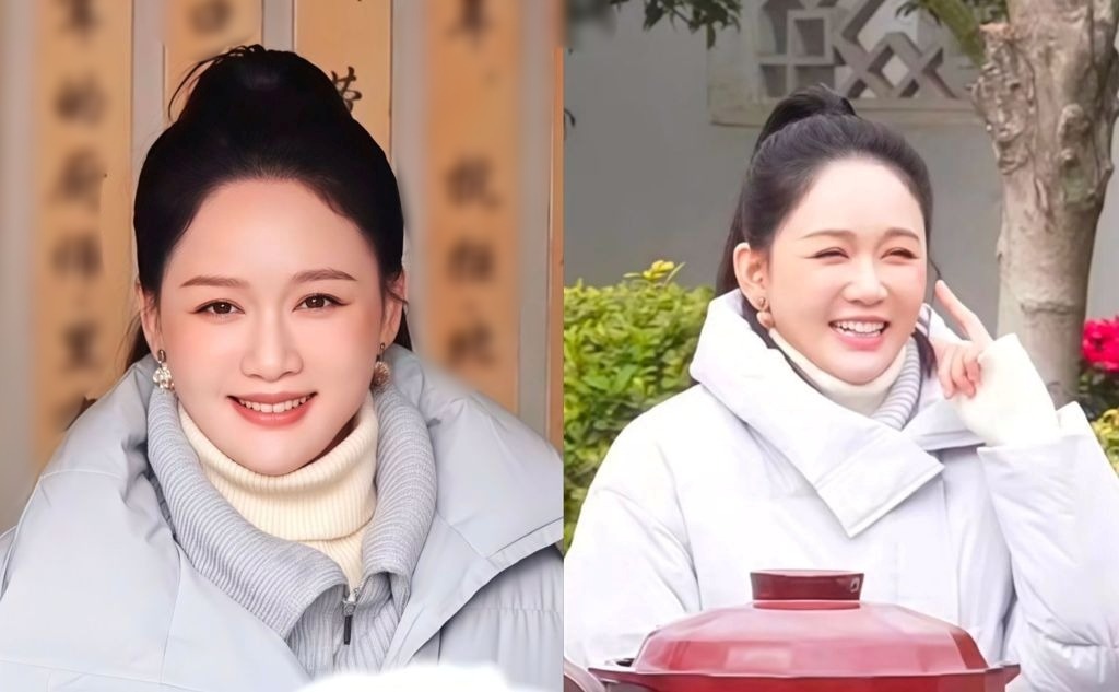 Ngỡ ngàng nhan sắc cam thường của Trần Kiều Ân sau khi lộ mặt sưng phồng, xô lệch cứng đơ như tượng sáp- Ảnh 5.