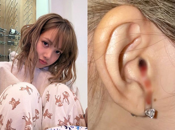 Lisa (BLACKPINK) lên tiếng về bức ảnh chảy máu tai gây hoang mang khắp MXH- Ảnh 1. Lisa (BLACKPINK) lên tiếng về bức ảnh chảy máu tai gây hoang mang khắp MXH- Ảnh 1.