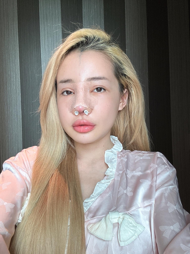 Ngân 98 bị biến chứng nhiễm trùng nặng sau 11 lần phẫu thuật thẩm mỹ- Ảnh 9.