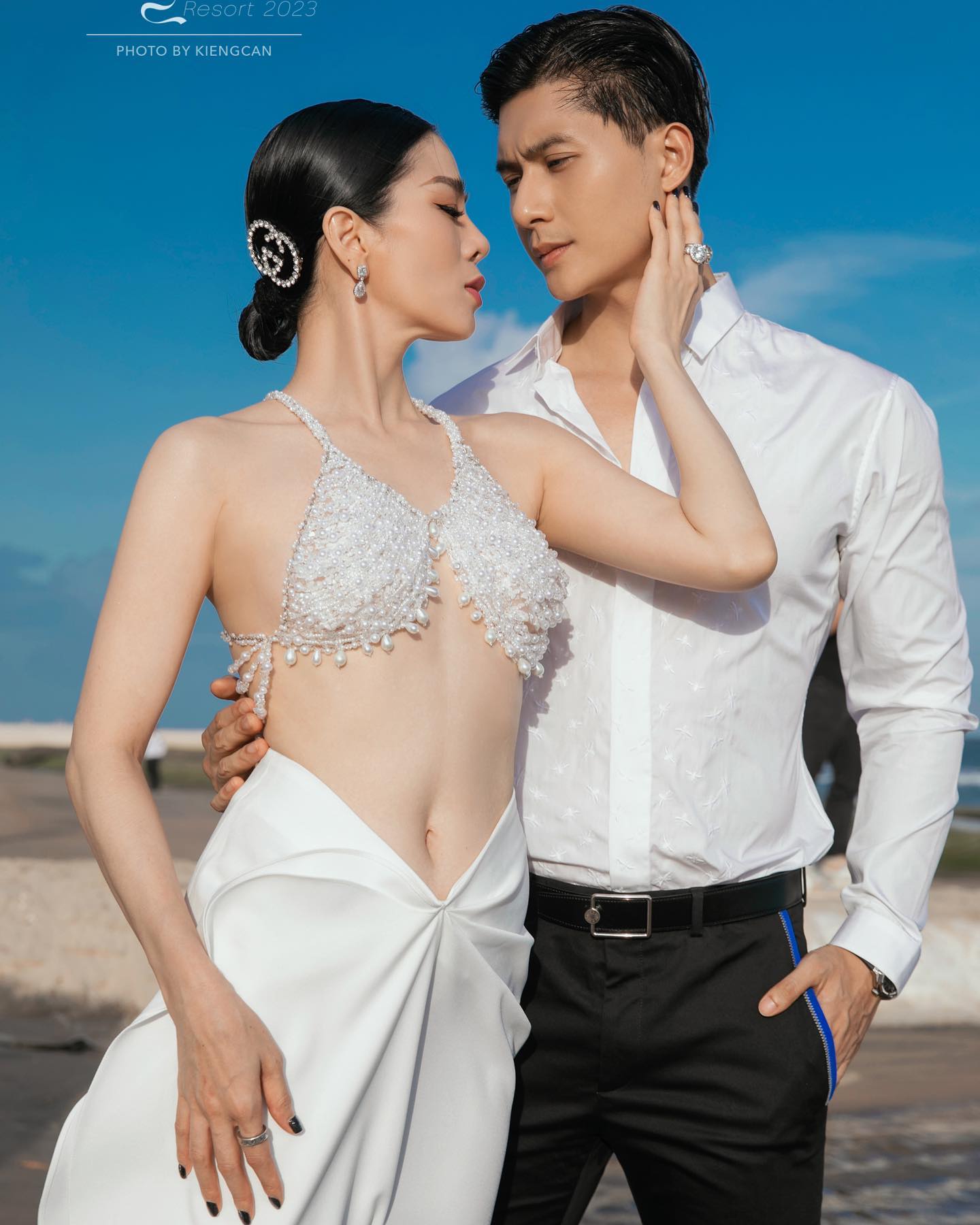 Phú bà Vbiz ở biệt thự hàng trăm tỷ suýt bị hoại tử vì phẫu thuật thẩm mỹ, phải huỷ show tháo sụn mũi gấp- Ảnh 9.