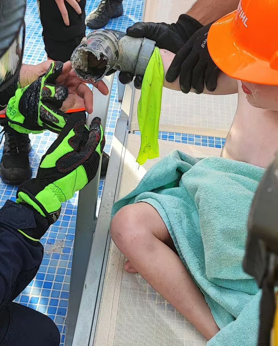 Bé 4 tuổi bị hút tay vào lỗ không che chắn ở hồ bơi ở Tây Ban Nha. (Ảnh: Bombers de Mallorca)