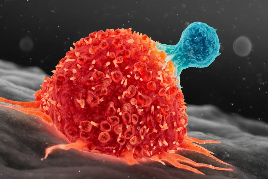 Số ca ung thư sẽ tăng mạnh trong 25 năm tới- Ảnh 2.