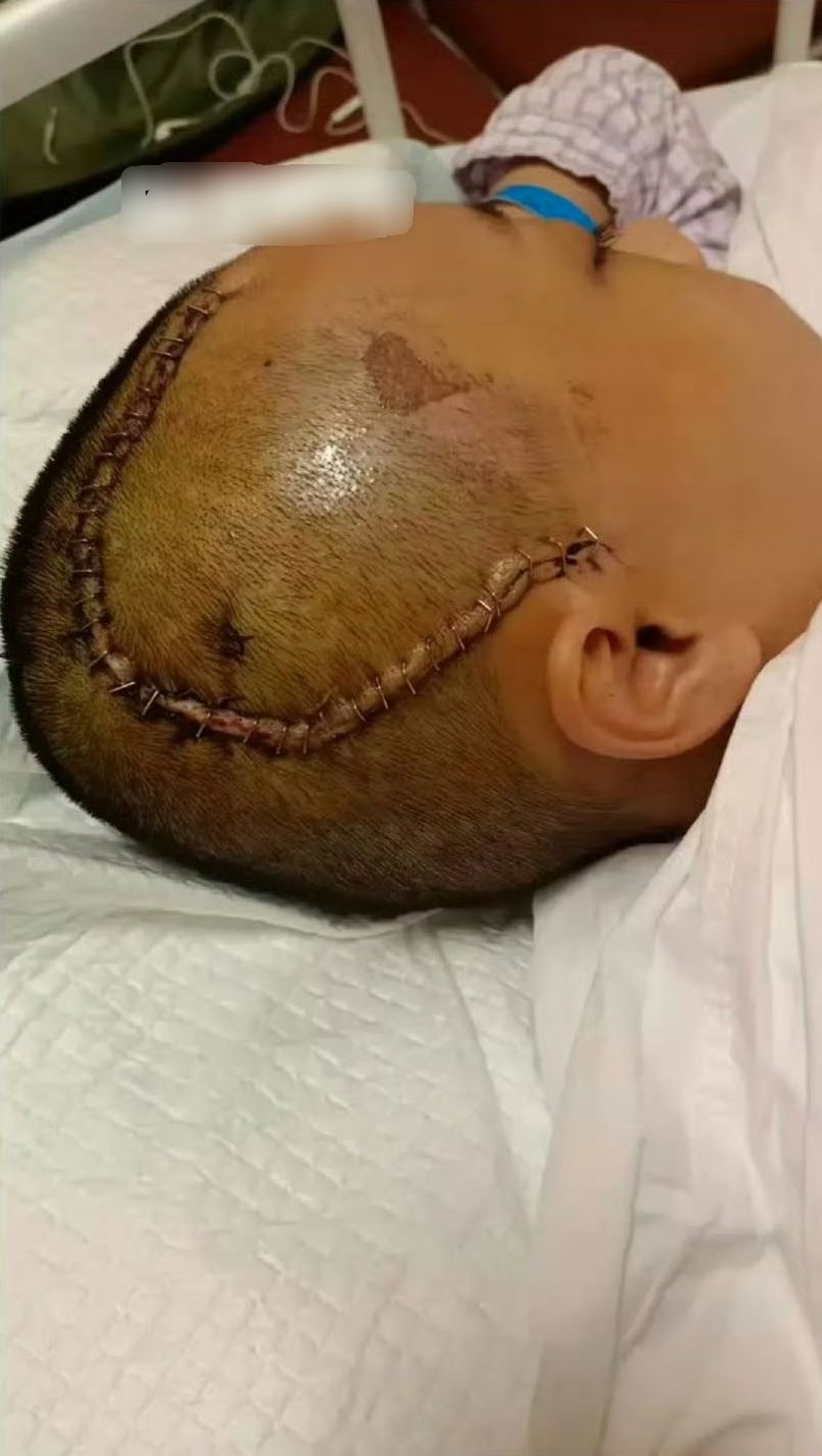 MXH náo loạn vì 1 nữ diễn viên bị tai nạn đến mất trí nhớ, 10 tháng đau đớn tưởng chết chẳng ai hay- Ảnh 3.