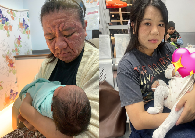 Xót xa gương mặt biến dạng sau khi mang thai của người mẹ trẻ, nhìn lại nhan sắc xinh đẹp trước đó càng không dám tin- Ảnh 2.