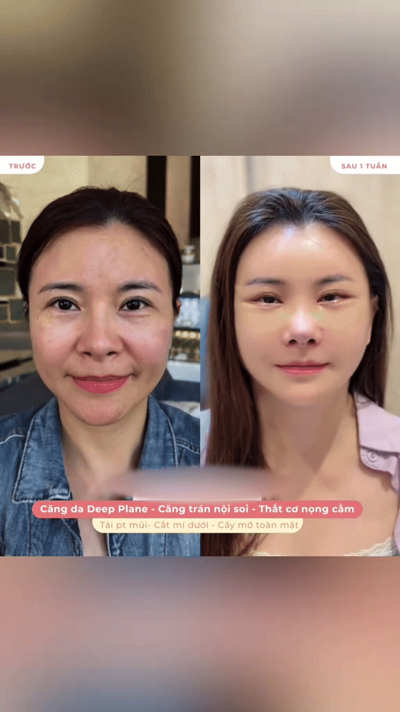 Diễn viên Kim Oanh công khai mặt mộc hậu trùng tu ở Hàn Quốc, đẹp thế nào mà dàn sao vào khen tới tấp?- Ảnh 3.