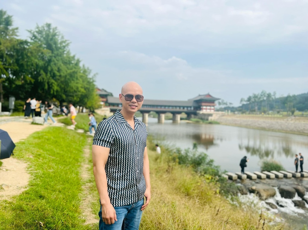 Sao nam Vbiz khổ sở vì không mọc được tóc, trí nhớ giảm sút do ngã từ tầng 3- Ảnh 2.