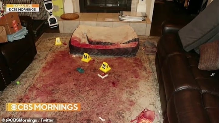 Cô gái bị chó dữ cắn 800 nhát trên mặt có diện mạo mới sau 4 năm phẫu thuật- Ảnh 6.