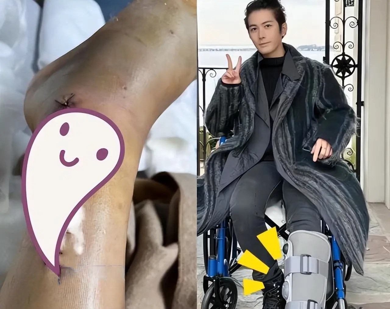 Vai diễn vận vào đời: Sao nam trải qua 4 ca phẫu thuật trong 2 năm, 11 bộ phim bị gỡ- Ảnh 5.