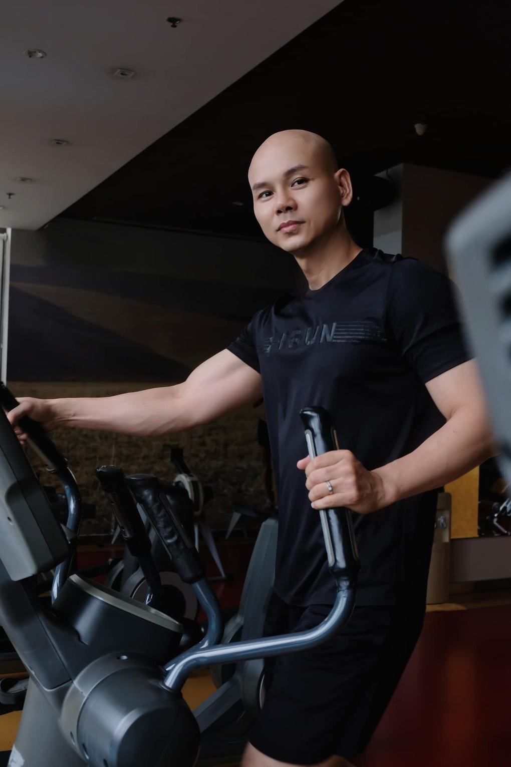 Sao nam Vbiz khổ sở vì không mọc được tóc, trí nhớ giảm sút do ngã từ tầng 3- Ảnh 6.