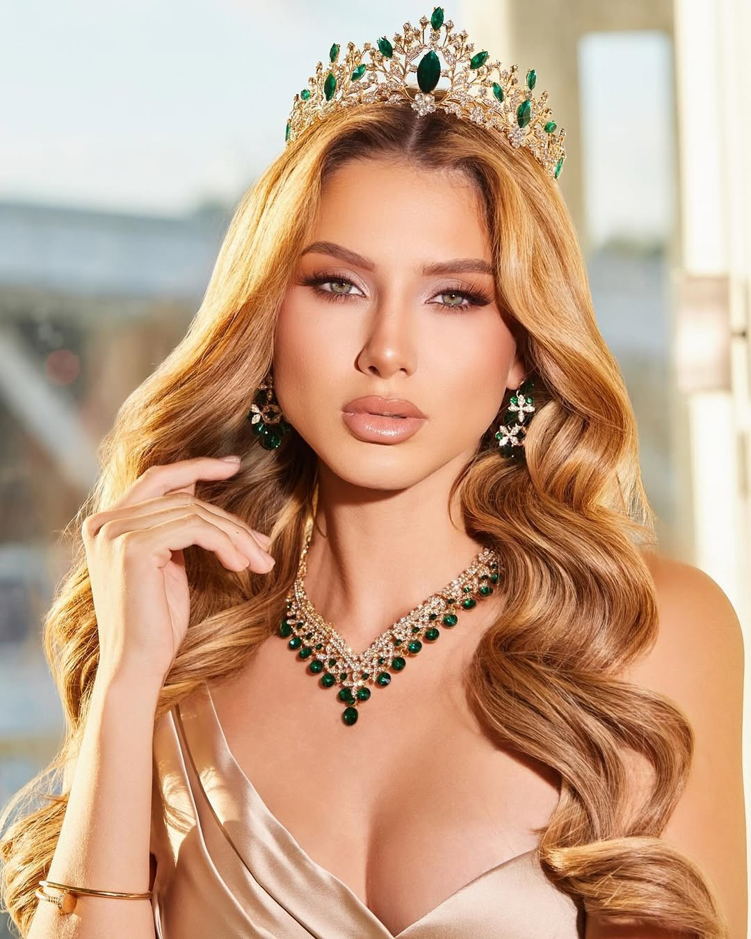 Hoa hậu 25 tuổi gặp tai nạn giao thông nghiêm trọng- Ảnh 2.