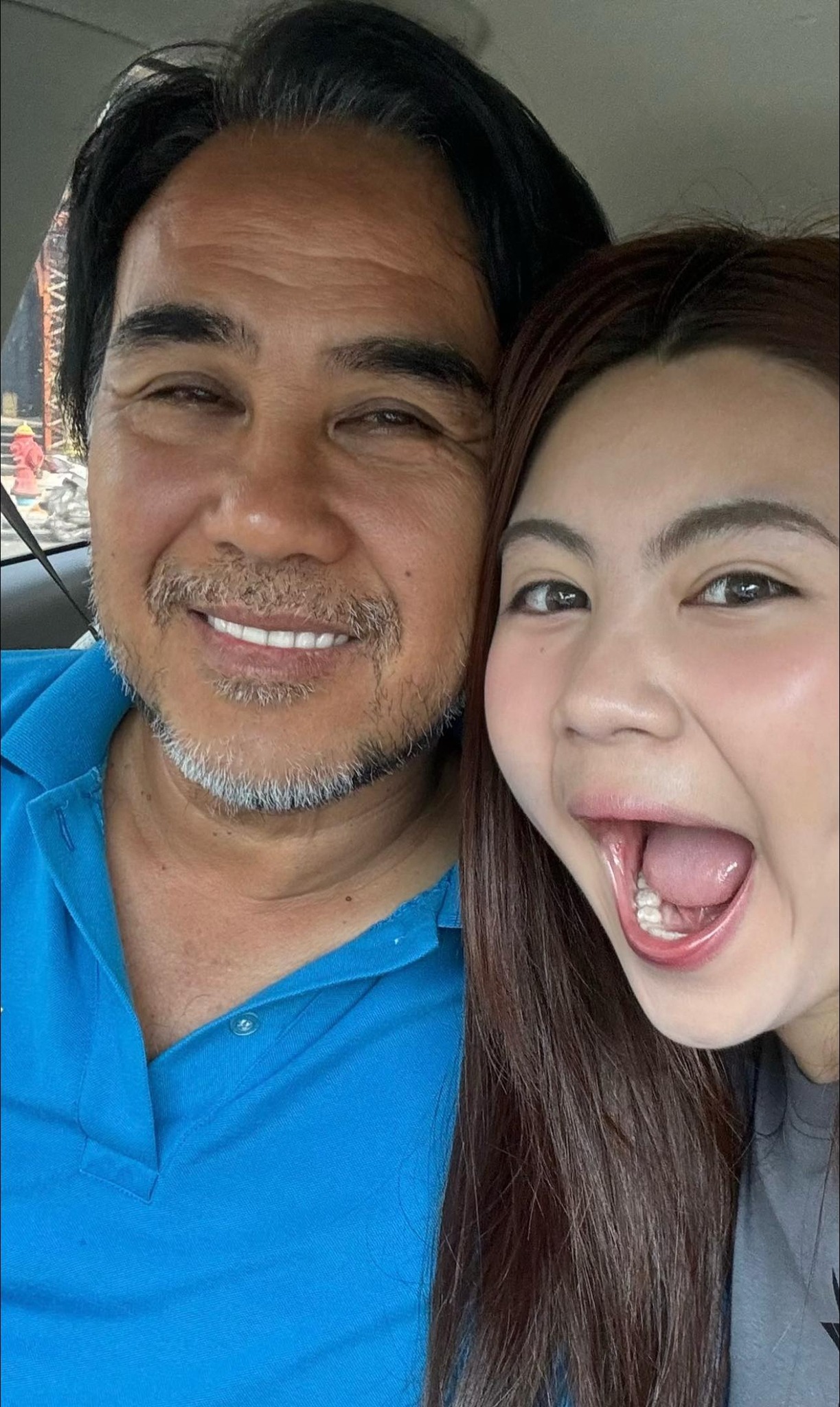 Hết Lọ Lem đến lượt Hạt Dẻ gặp