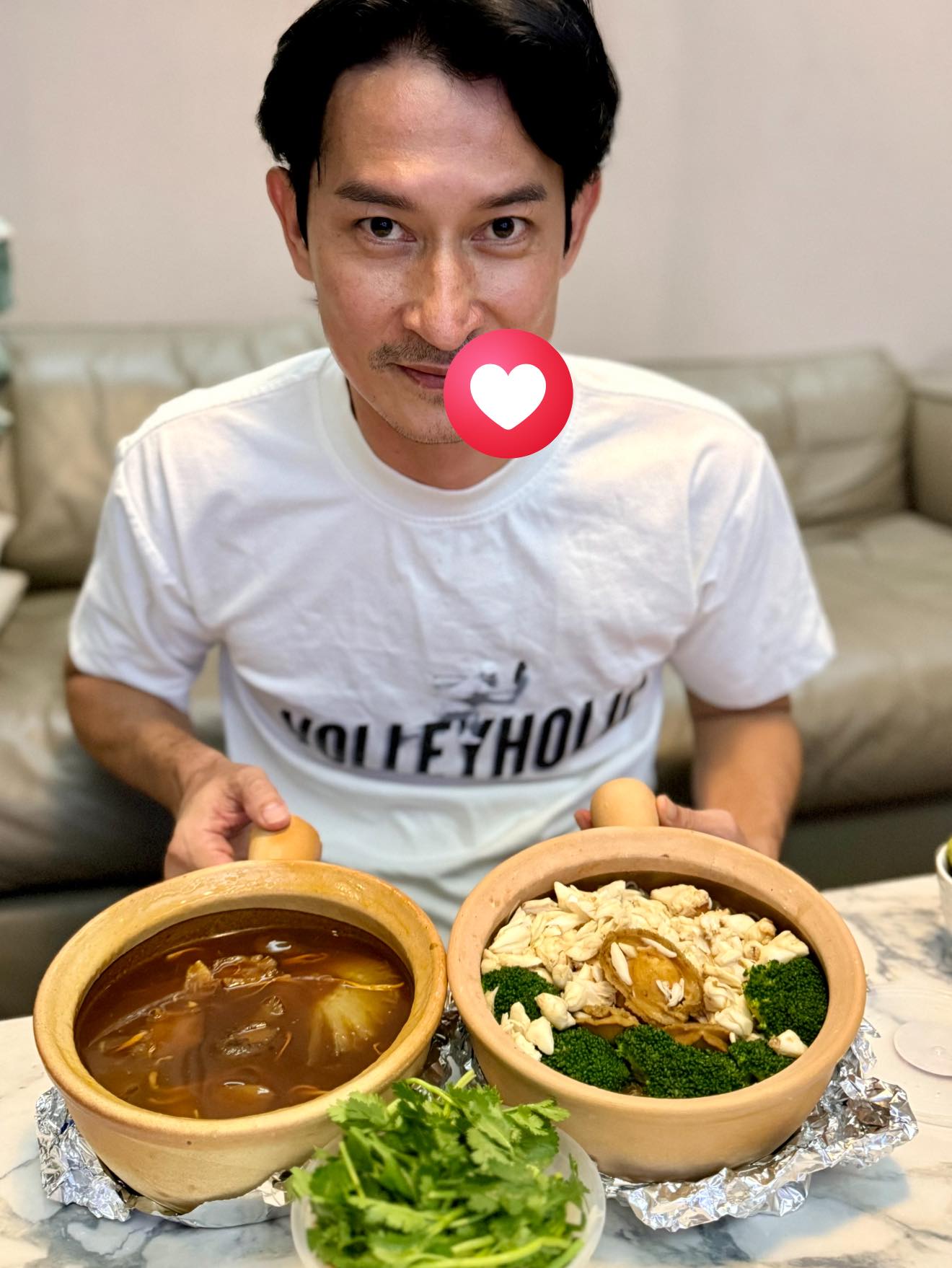 Sao nam Vbiz hoảng hốt vì bị biến dạng mặt: Hé lộ tình trạng nghiêm trọng hiện tại- Ảnh 1.