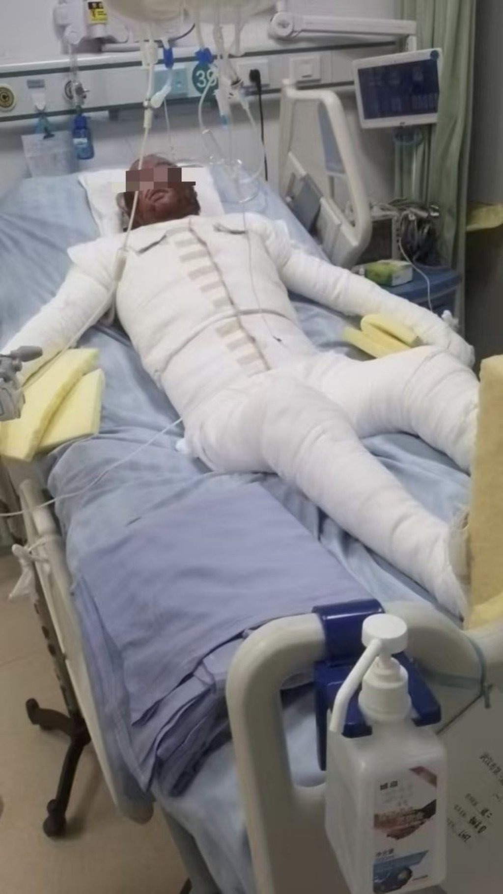 Chàng trai khôi ngô bị bỏng 90% do xe đạp điện nổ khi sạc, bạn cùng phòng có hành động phẫn nộ- Ảnh 3.