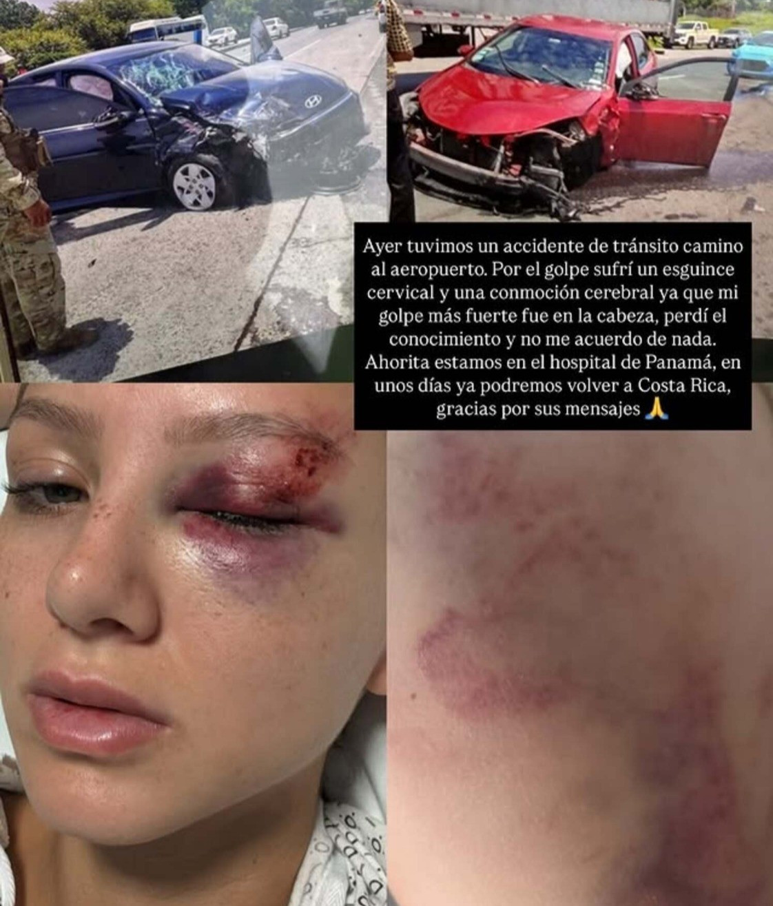 Hoa hậu 25 tuổi gặp tai nạn giao thông nghiêm trọng- Ảnh 1.