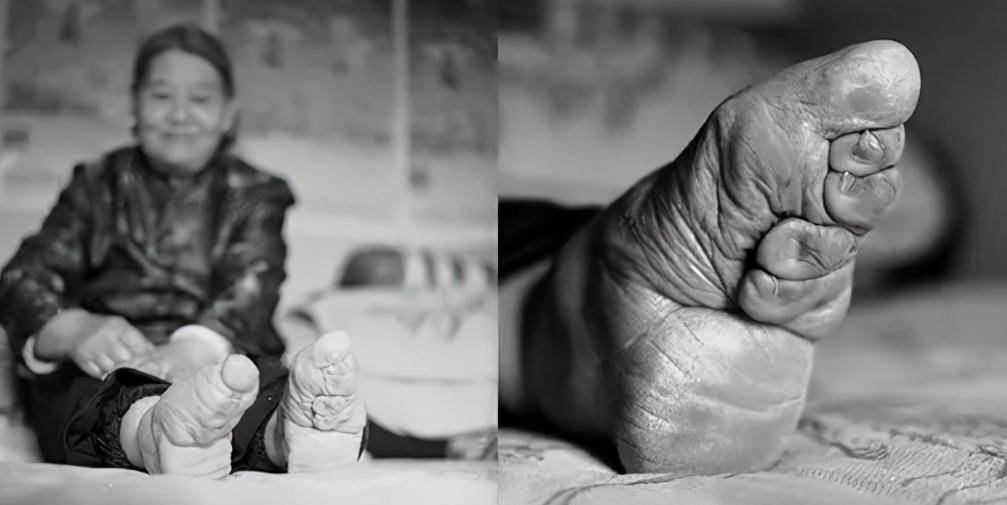 Cô gái 15 tuổi lấy chồng giàu nhờ