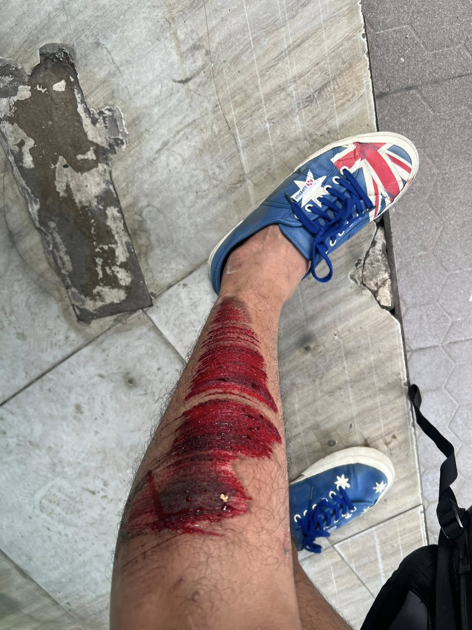 Quách Ngọc Tuyên bị tai nạn- Ảnh 1.