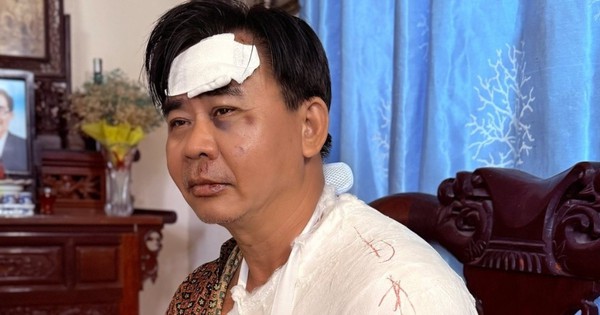 Tình trạng nghệ sĩ Chánh Thuận sau tai nạn xe 572114172 25144226151856141 3154022093597790407 n 5825 1762084192305 1762084192743448255373 76 0 774 1333 crop 17620842424011586093626jpg