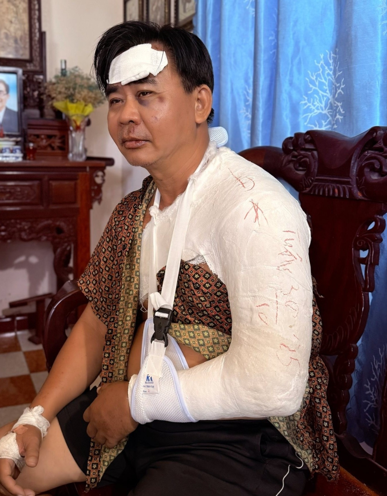 Tình trạng nghệ sĩ Chánh Thuận sau tai nạn xe- Ảnh 1.