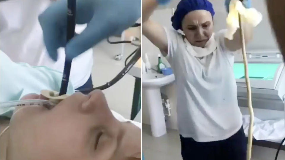 Kinh hoàng cảnh bác sĩ lôi con rắn dài 1,2m ra khỏi miệng một phụ nữ ở Nga- Ảnh 2.