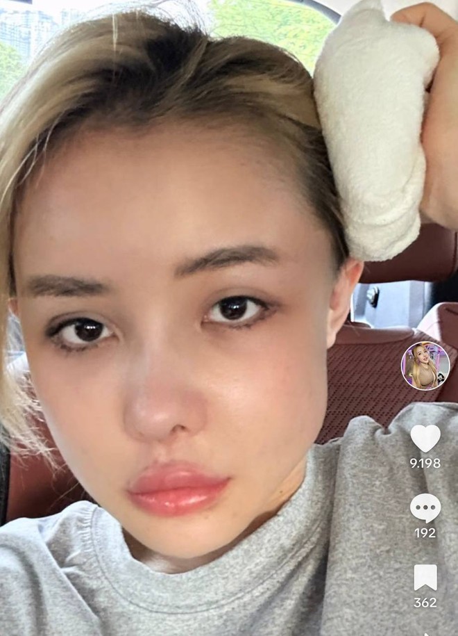 Ngân 98 nhập viện phẫu thuật gấp: Tình trạng nghiêm trọng, phải hủy liền 3 show diễn- Ảnh 5. Ngân 98 nhập viện phẫu thuật gấp: Tình trạng nghiêm trọng, phải hủy liền 3 show diễn- Ảnh 5.