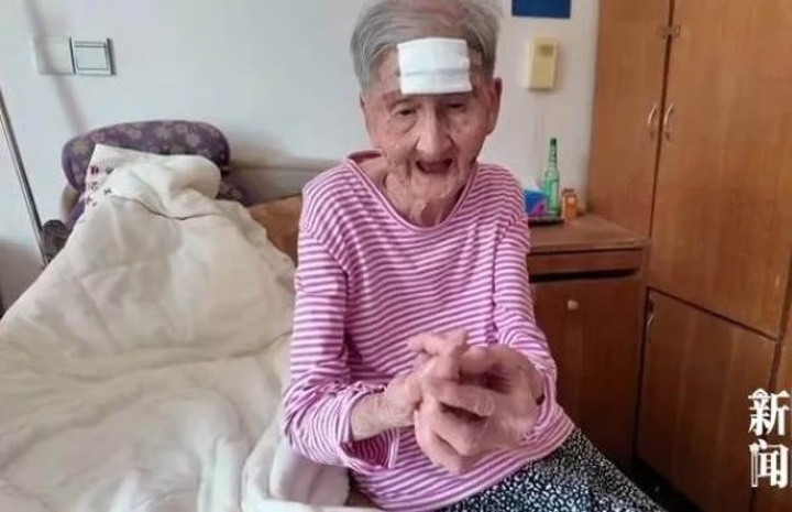 Cụ bà 98 tuổi dùng kéo cắt 'sừng trường thọ' trên trán, dẫn đến nguy kịch- Ảnh 3.