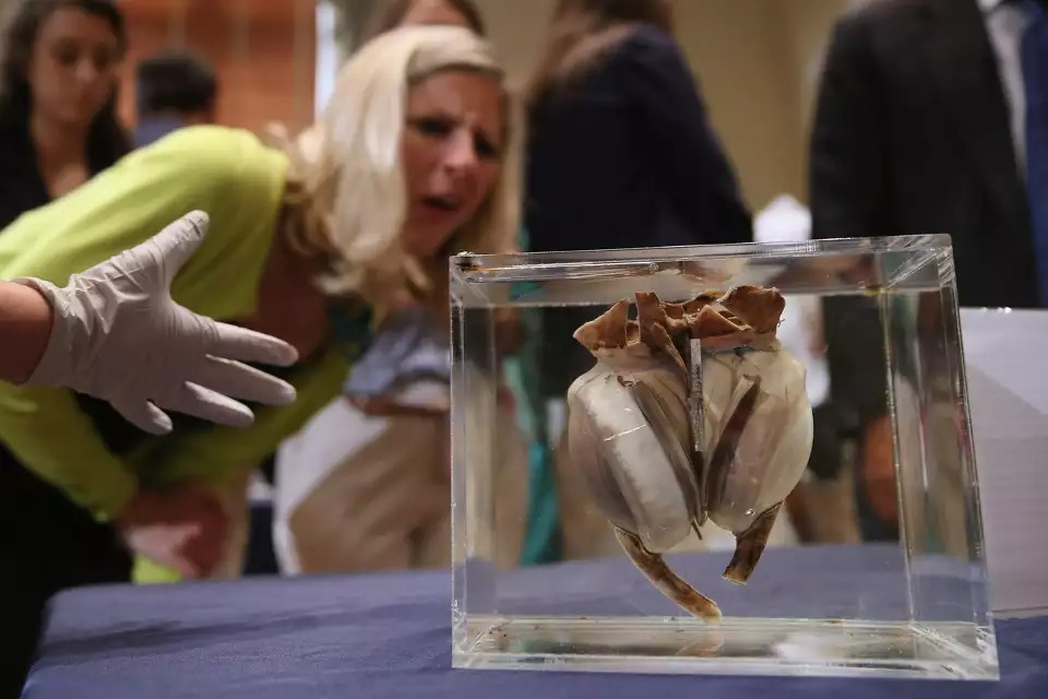 Ngày định mệnh của y học hiện đại: Ca cấy ghép tim nhân tạo đầu tiên trên thế giới và hành trình vượt qua giới hạn sự sống- Ảnh 5.