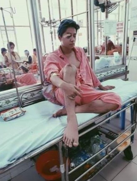 Anh Trai Say Hi bị tai nạn liệt nửa mặt, ám ảnh vì ngoại hình biến dạng- Ảnh 2.