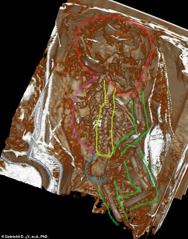 Bí mật động trời sau cánh tay ôm bụng suốt 1.200 năm của