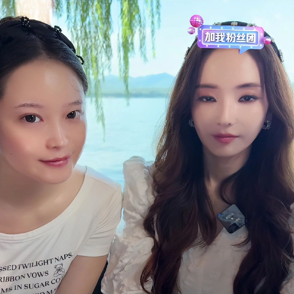 Mỹ nhân đẹp nhất Vườn Sao Băng làm sao thế này: Mặt mũi đơ như tượng, mắt lờ đờ, miệng cũng không mở nổi!- Ảnh 3. Mỹ nhân đẹp nhất Vườn Sao Băng làm sao thế này: Mặt mũi đơ như tượng, mắt lờ đờ, miệng cũng không mở nổi!- Ảnh 3.