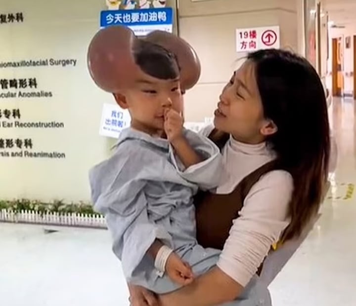 Nốt ruồi khổng lồ phủ kín hộp sọ khiến cậu bé có ngoại hình giống chuột Mickey- Ảnh 3.