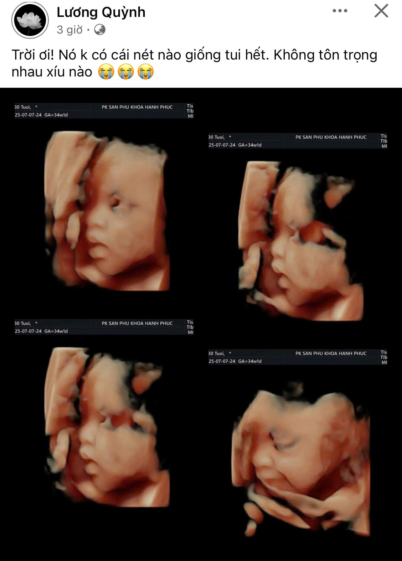 Mẹ bầu Vbiz mang thai lần 2: Đau đớn toàn thân, đi lại khó khăn ở tháng thứ 8- Ảnh 1.