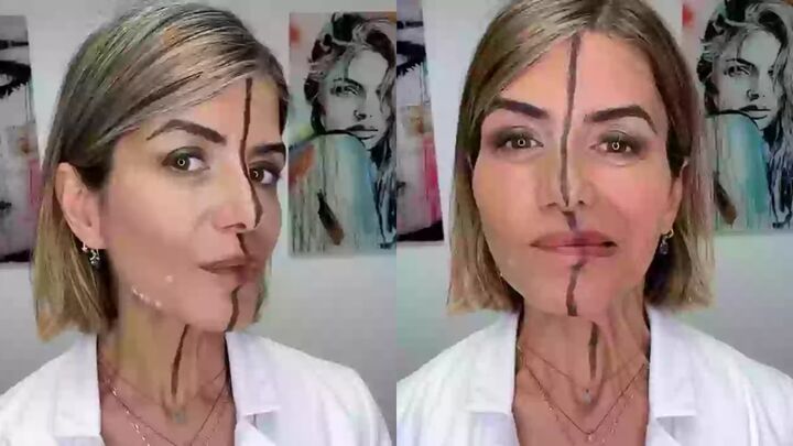 Nữ bác sĩ tiêm botox nửa khuôn mặt để chứng minh tác hại của cách làm đẹp này- Ảnh 1.