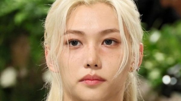 Ca sĩ điển trai gãy tay sau tai nạn với xe buýt adt1739673849 ca si dien trai gay tay sau tai nan anh cat 3 2 auto cropjpg