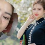 Dương Hoàng Yến môi méo, sưng mặt vì liệt dây thần kinh số 7 adt1742524905 duonghoangyentop1 0518 5062 0607 anh cat 3 2 auto cropjpg