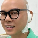 Phan Đinh Tùng phẫu thuật 3 tiếng vá màng nhĩ adt1746784421 4753 1651 3038 anh cat 3 2 auto cropjpg