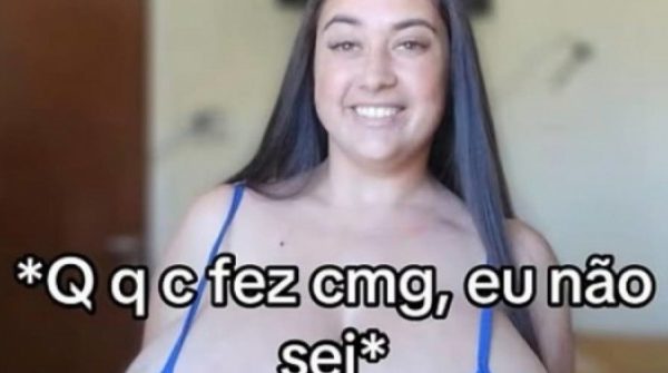 Cô gái vui mừng khi được giải thoát khỏi 'bộ ngực khủng' 12 kg 29 Cô gái vui mừng khi được giải thoát khỏi 'bộ ngực khủng' 12 kg adt1753233699 ngucto1t 6183 7620 6485 anh cat 3 2 auto cropjpg