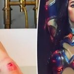 Katy Perry bị thương trong chuyến lưu diễn adt1754739575 dewatermarkai8 175 9702 7706 2280 anh cat 3 2 auto cropjpg