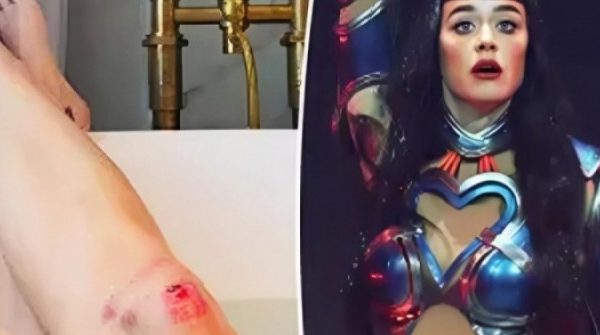 Katy Perry bị thương trong chuyến lưu diễn 28 Katy Perry bị thương trong chuyến lưu diễn adt1754739575 dewatermarkai8 175 9702 7706 2280 anh cat 3 2 auto cropjpg