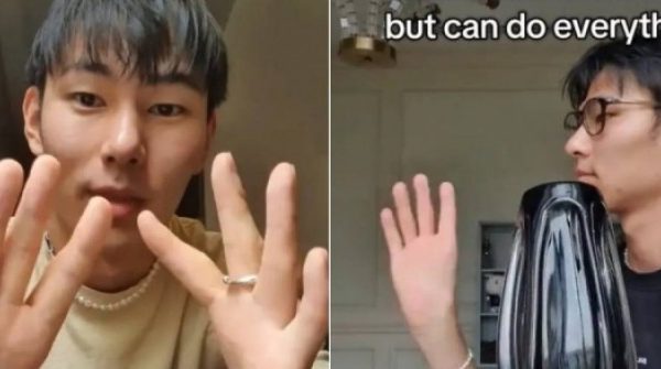 Không ngón cái, chàng trai vẫn làm đủ việc khiến ai cũng ngả mũ adt1758371496 thumbst 3381 3813 3522 anh cat 3 2 auto cropjpg