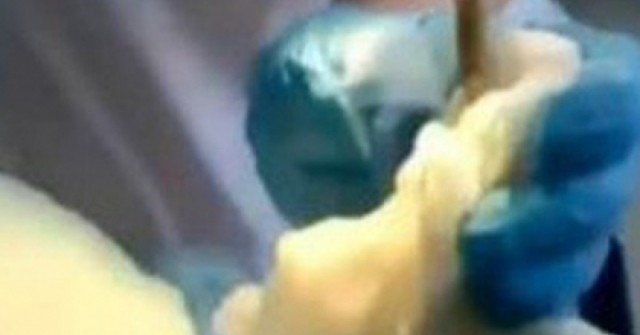 Đang ngủ ngoài sân, người phụ nữ sốc nặng khi bị con rắn 1,2m chui vào miệng adt1758875434 dang ngu ngoai san nguoi phu nu soc anh cat 3 2 auto cropjpg 1