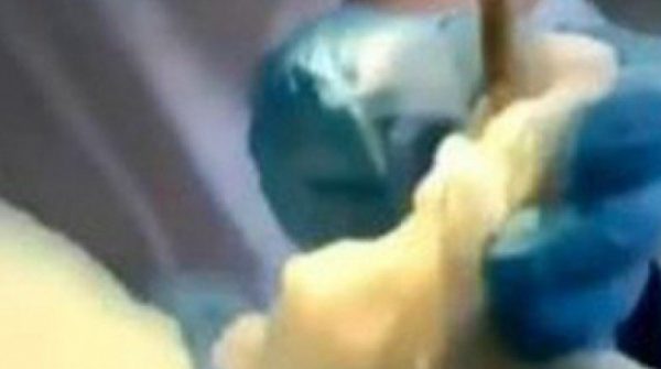 Đang ngủ ngoài sân, người phụ nữ sốc nặng khi bị con rắn 1,2m chui vào miệng adt1758875434 dang ngu ngoai san nguoi phu nu soc anh cat 3 2 auto cropjpg