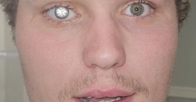 adt1761139372-kimcuong1t-5329-1714-5376-anh-cat-3-2-auto-cropjpg-1 Chủ tiệm vàng gắn kim cương 2 triệu USD vào mắt giả adt1761139372 kimcuong1t 5329 1714 5376 anh cat 3 2 auto cropjpg 1