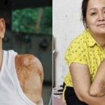 Mất 2 tay 1 chân sau tai nạn, người đàn ông tìm lại cuộc đời nhờ tình yêu của vợ adt1762303319 mat 2 tay 1 chan sau tai nan nguoi d anh cat 3 2 auto cropjpg