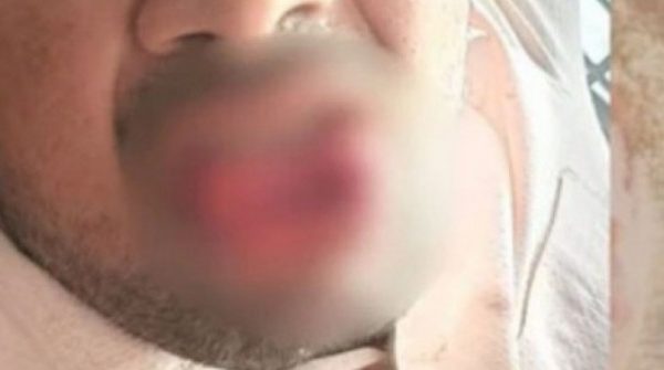 Bị quấy rối trên đường, cô gái đáp trả theo cách khiến kẻ tấn công choáng váng adt1763527374 can dut luoi2 96177 0 0 589 1125 cro anh cat 3 2 auto cropjpg