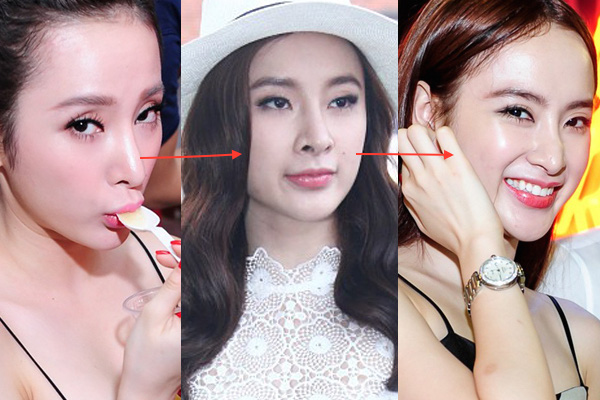 angela-phuong-trinh-tu-ve-dep-nang-tho-khong-tuoi-den-tan-ta-vi-nghien-tham-my-6-1754674157393-1754674157679121462220-1754703951986-17547039522611794126651 "Nữ hoàng thị phi Vbiz" bị biến dạng mũi, chưa đủ 18 tuổi đã "dao kéo" angela phuong trinh tu ve dep nang tho khong tuoi den tan ta vi nghien tham my 6 1754674157393 1754674157679121462220 1754703951986 17547039522611794126651