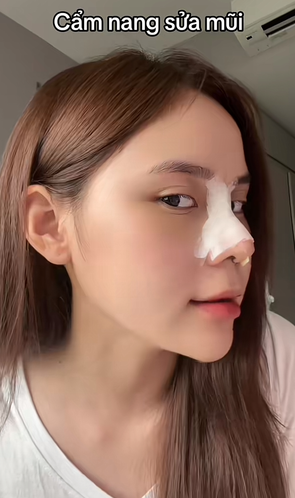 Hậu phẫu thuật thẩm mỹ,