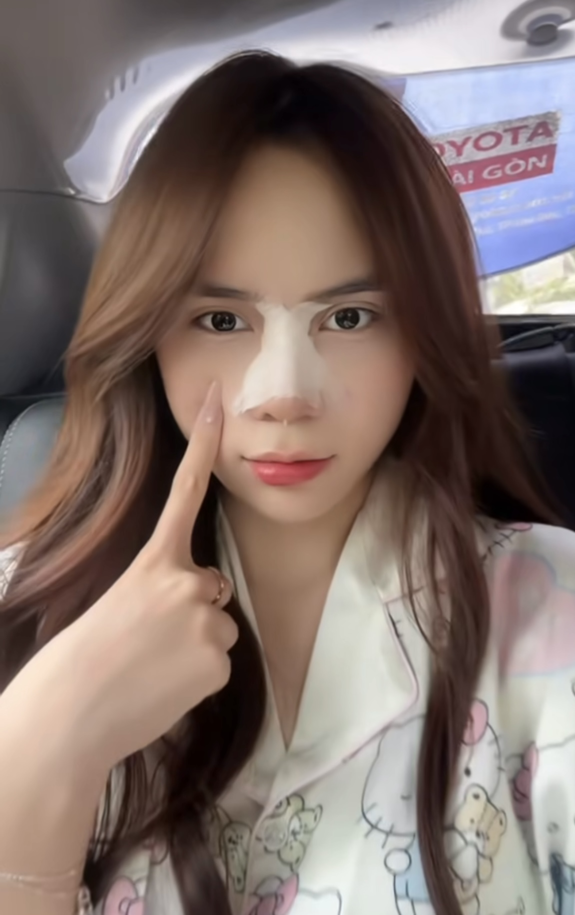 Hậu phẫu thuật thẩm mỹ,