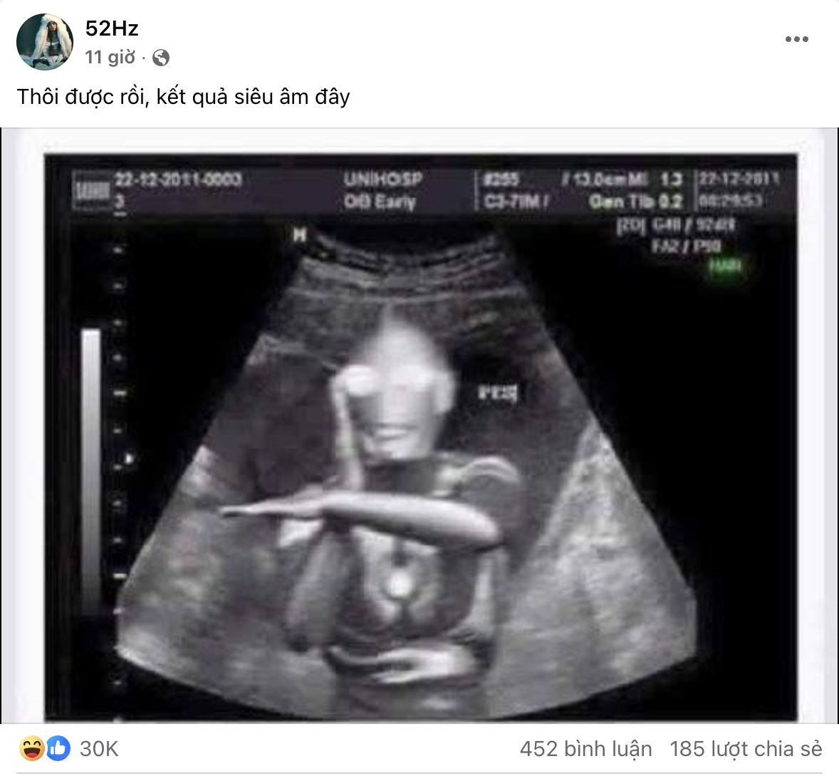 1 Em Xinh phát hiện mang thai con đầu lòng giữa lúc đang ghi hình?- Ảnh 1.