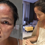 Gương mặt biến dạng sau sinh của H'Hen Niê ava 13 176120859109890323605 17 0 268 480 crop 1761208607753709520571png