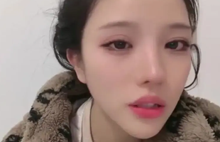 Sốc với nữ streamer vừa phẫu thuật hộp sọ đã lên sóng live avatar1736220198206 17362201984001583810849png